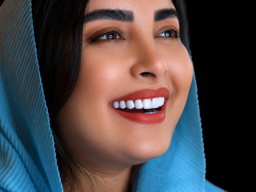 نمونه کار لبخند راگا 1
