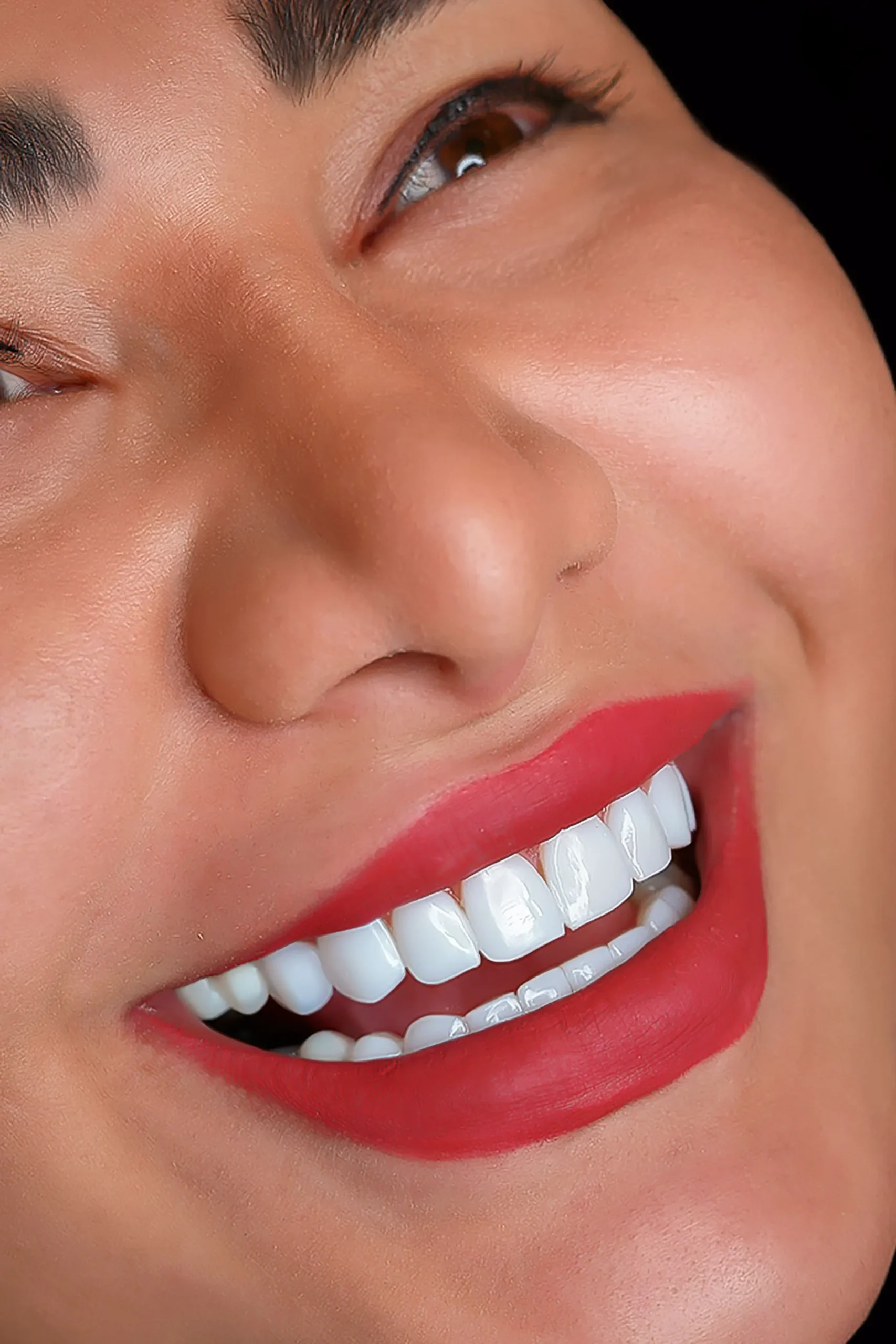 نمونه کار لبخند راگا