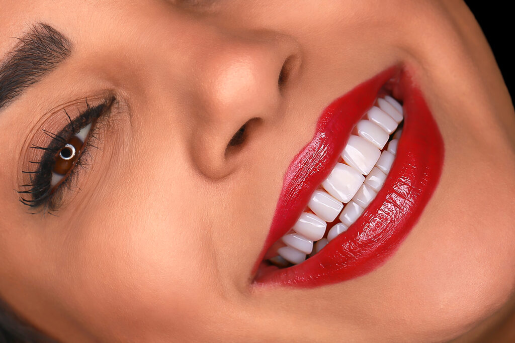 نمونه کار لبخند راگا 7