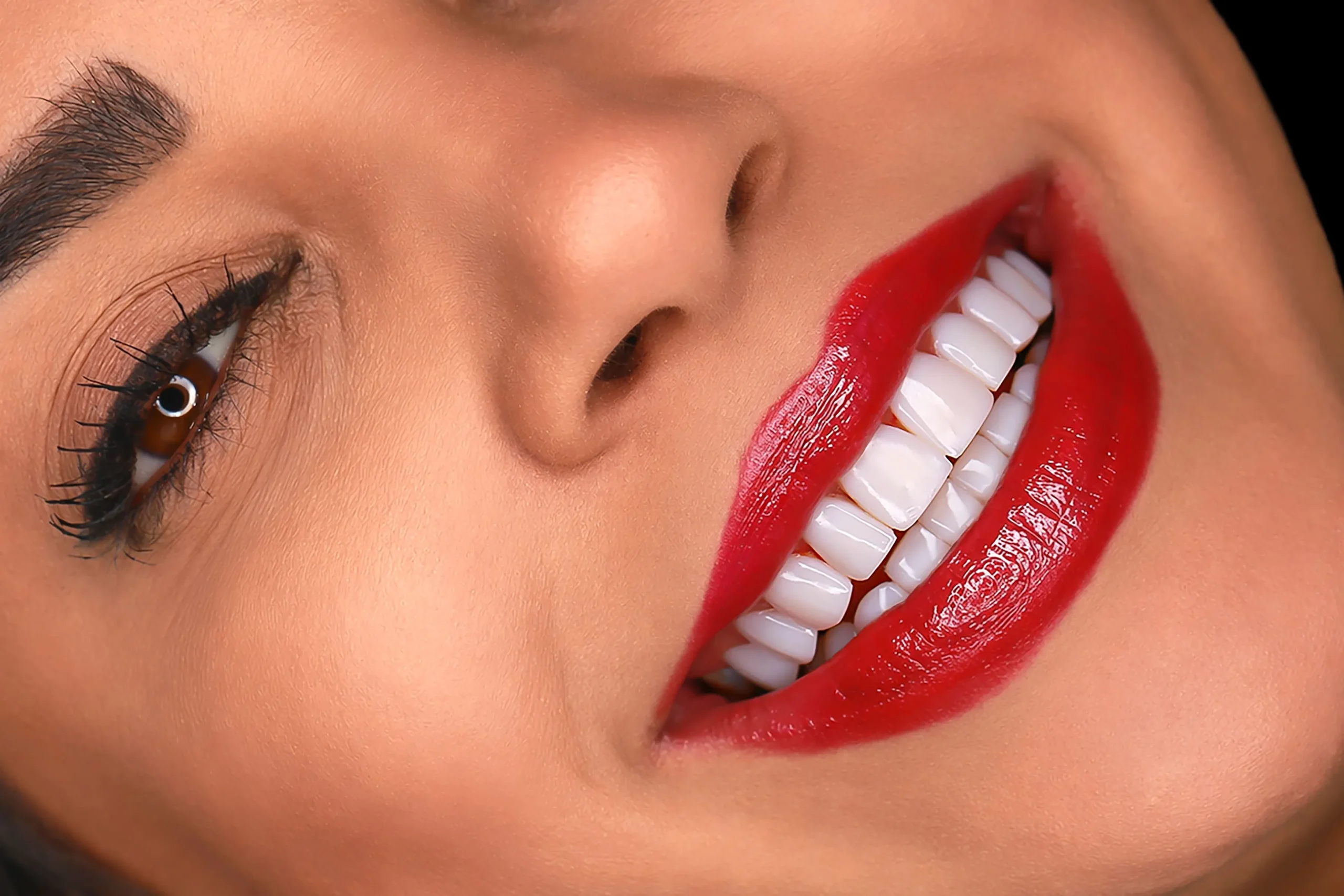 نمونه کار لبخند راگا 2