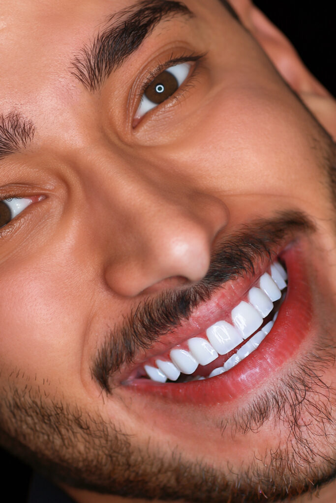 نمونه کار لبخند راگا 8