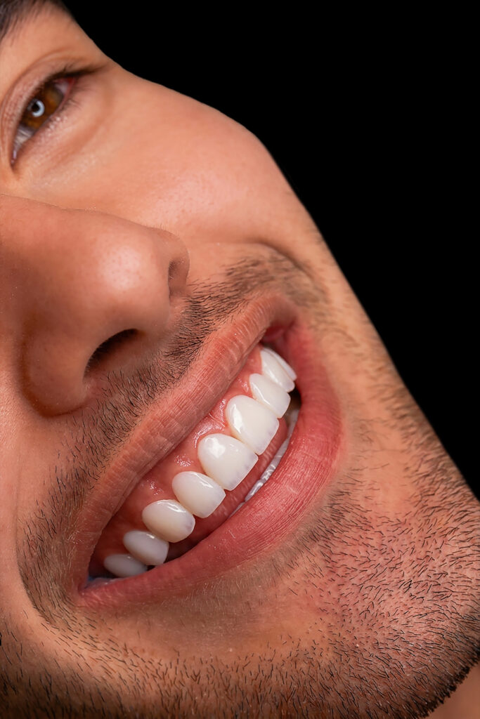 نمونه کار لبخند راگا 9
