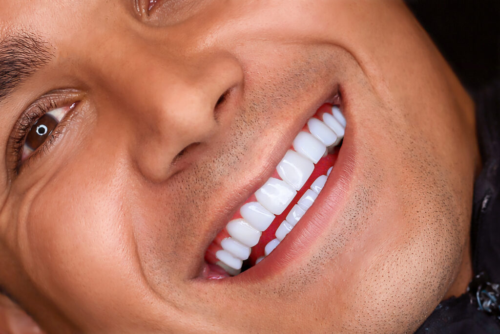 نمونه کار لبخند راگا 10