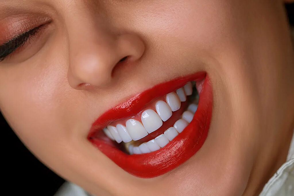 نمونه کار لبخند راگا 14