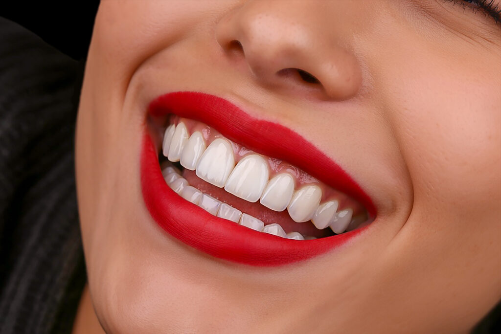 نمونه کار لبخند راگا 16