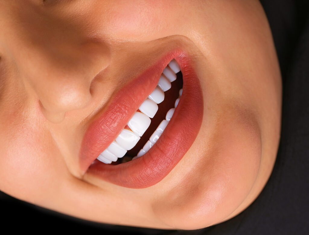 نمونه کار لبخند راگا 19