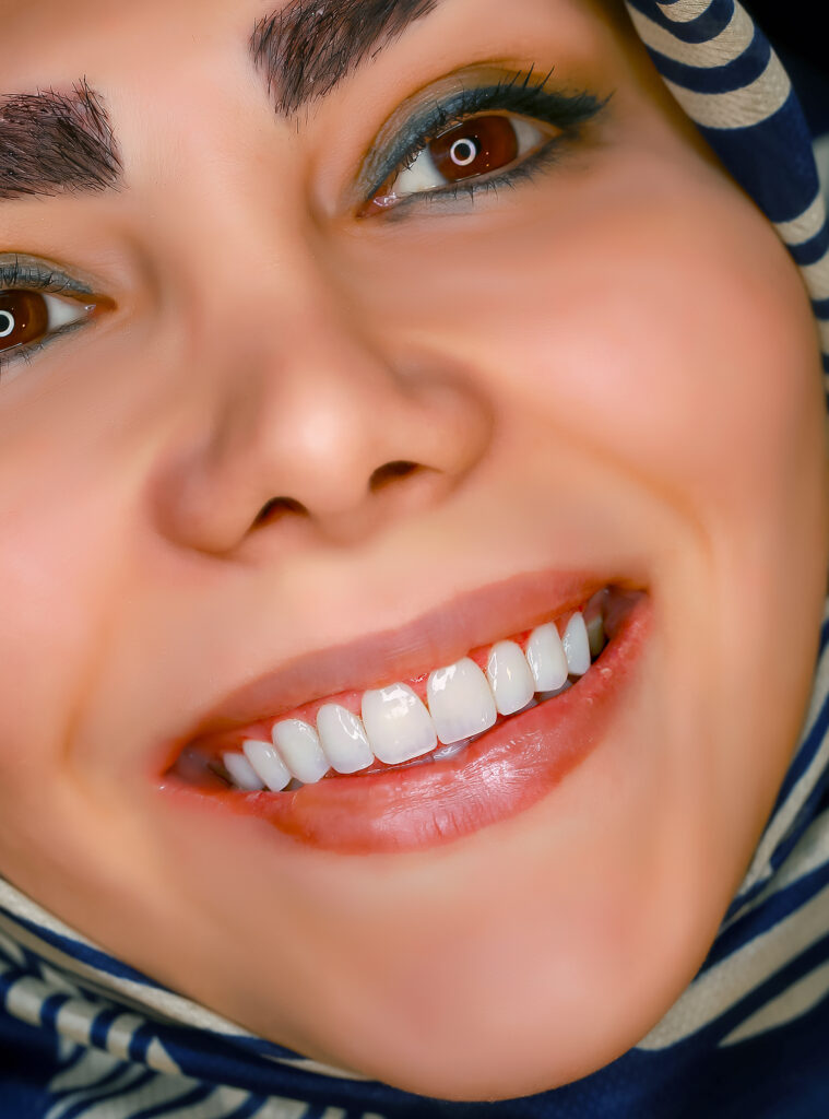 نمونه کار لبخند راگا 21