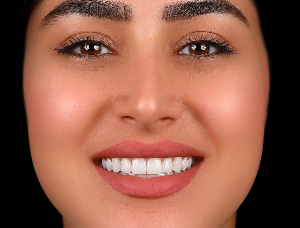نمونه کار لبخند راگا 23