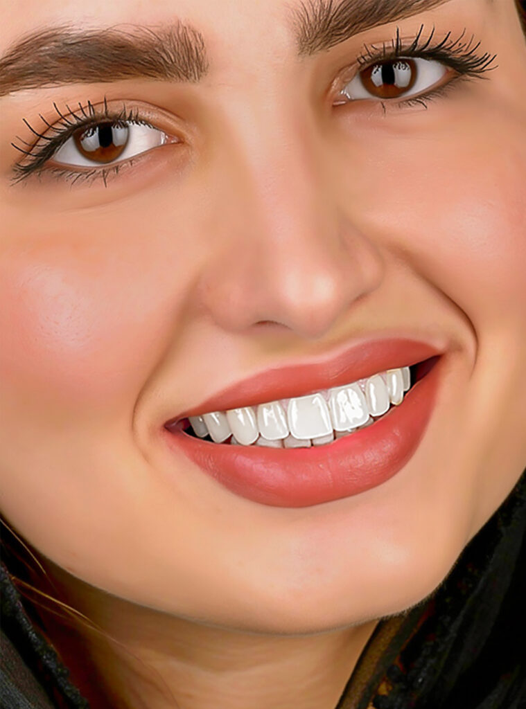 نمونه کار لبخند راگا 24