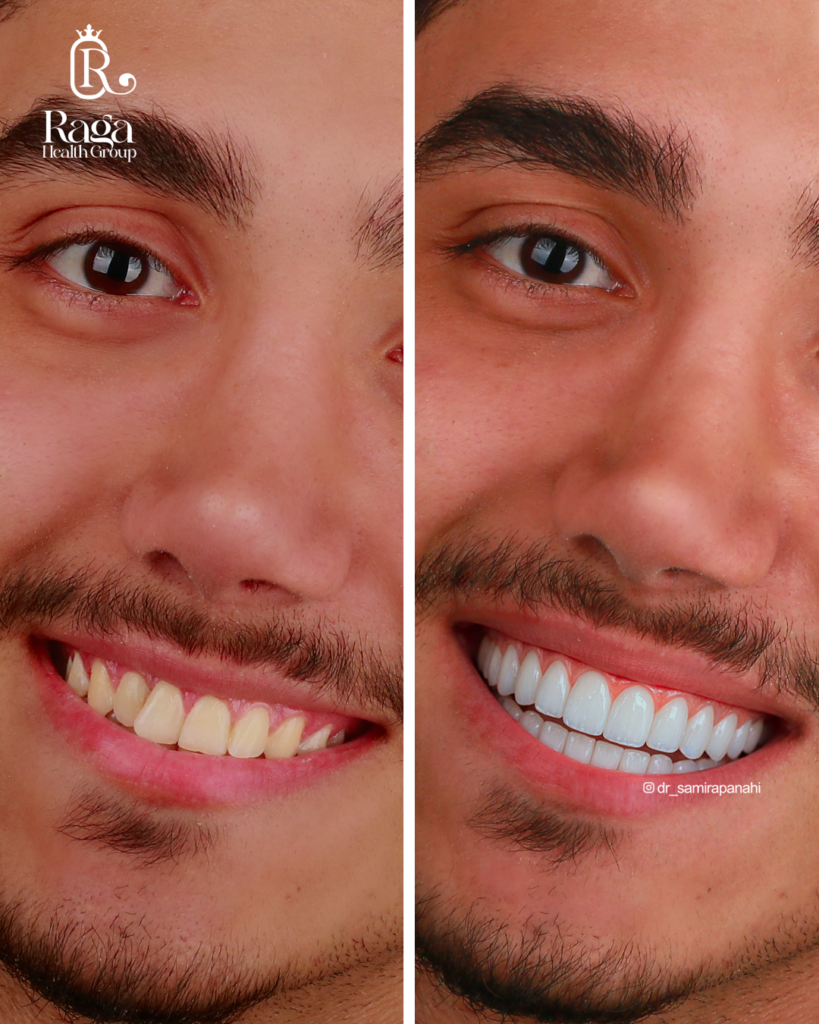 نمونه کار لبخند راگا 30