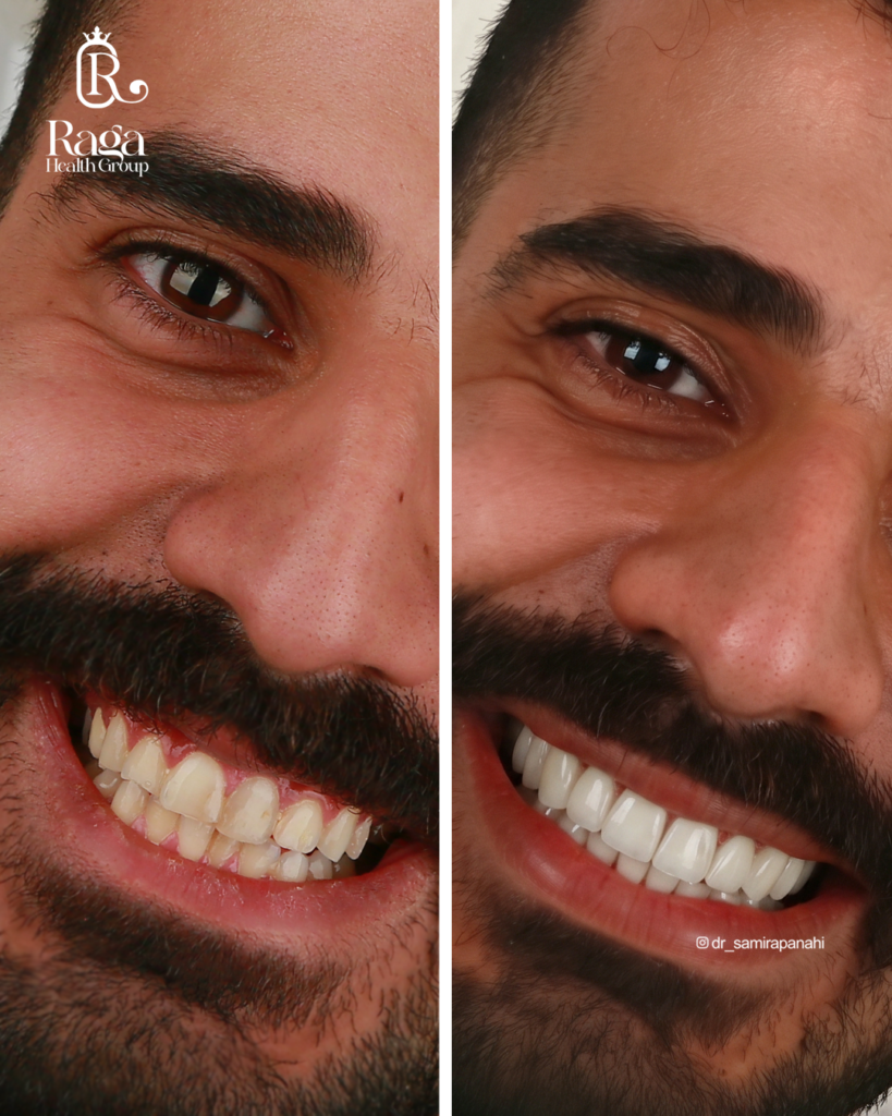 نمونه کار لبخند راگا 31