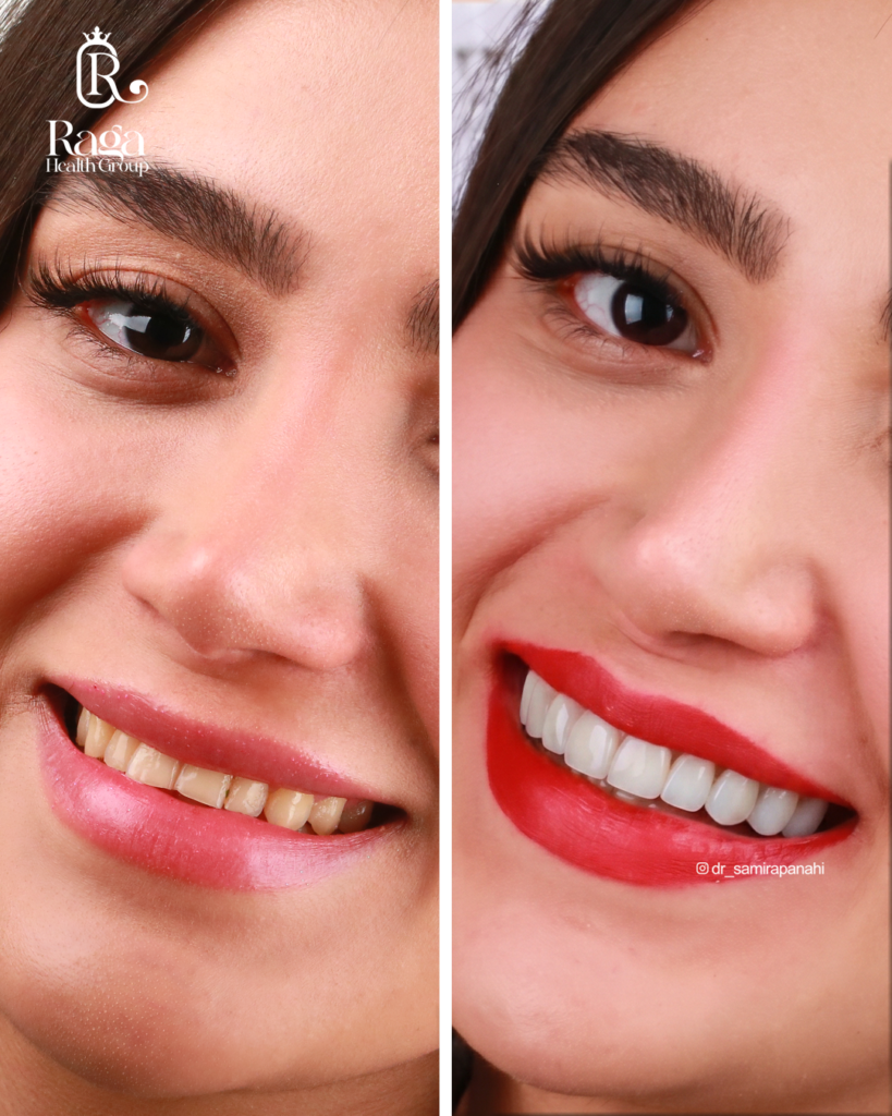 نمونه کار لبخند راگا 32