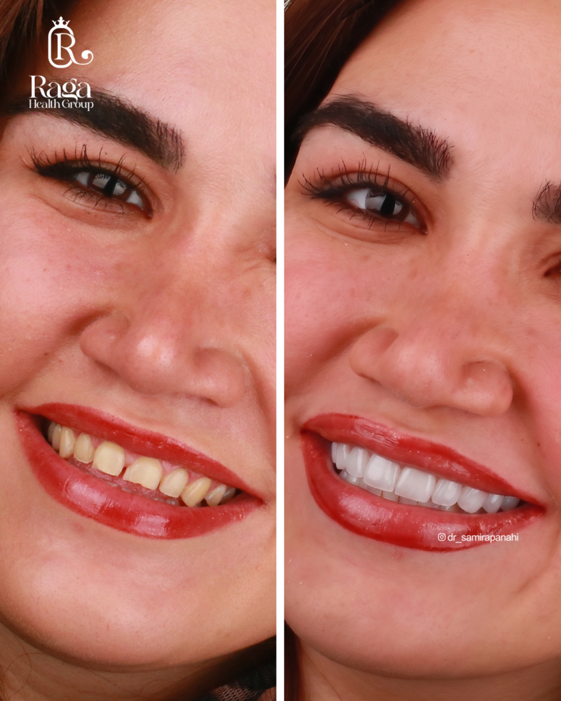 نمونه کار لبخند راگا 33