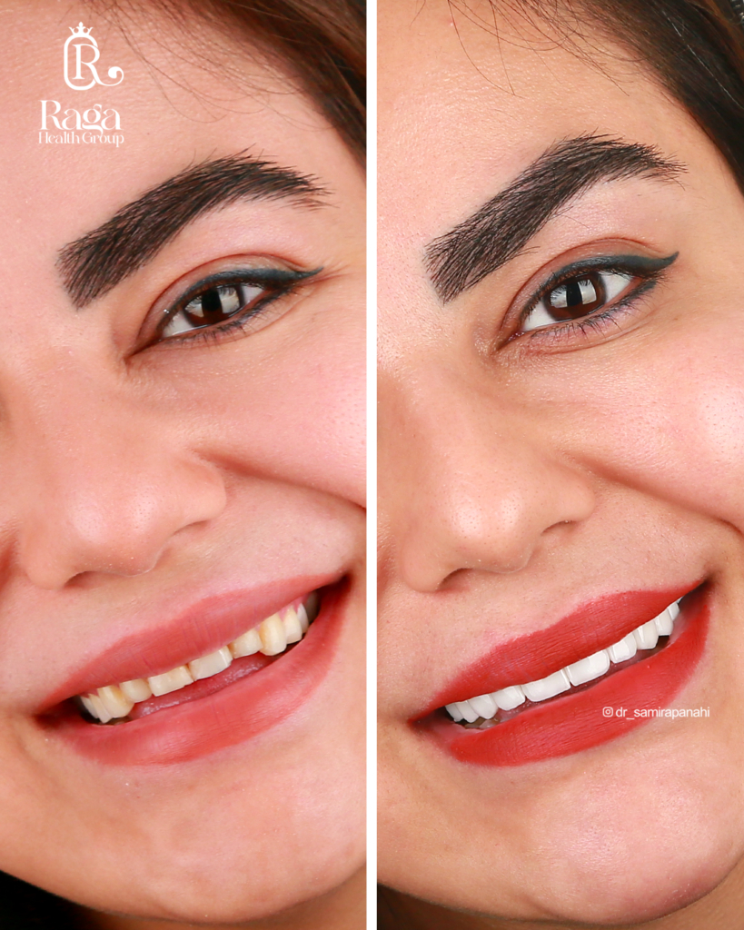 نمونه کار لبخند راگا 35