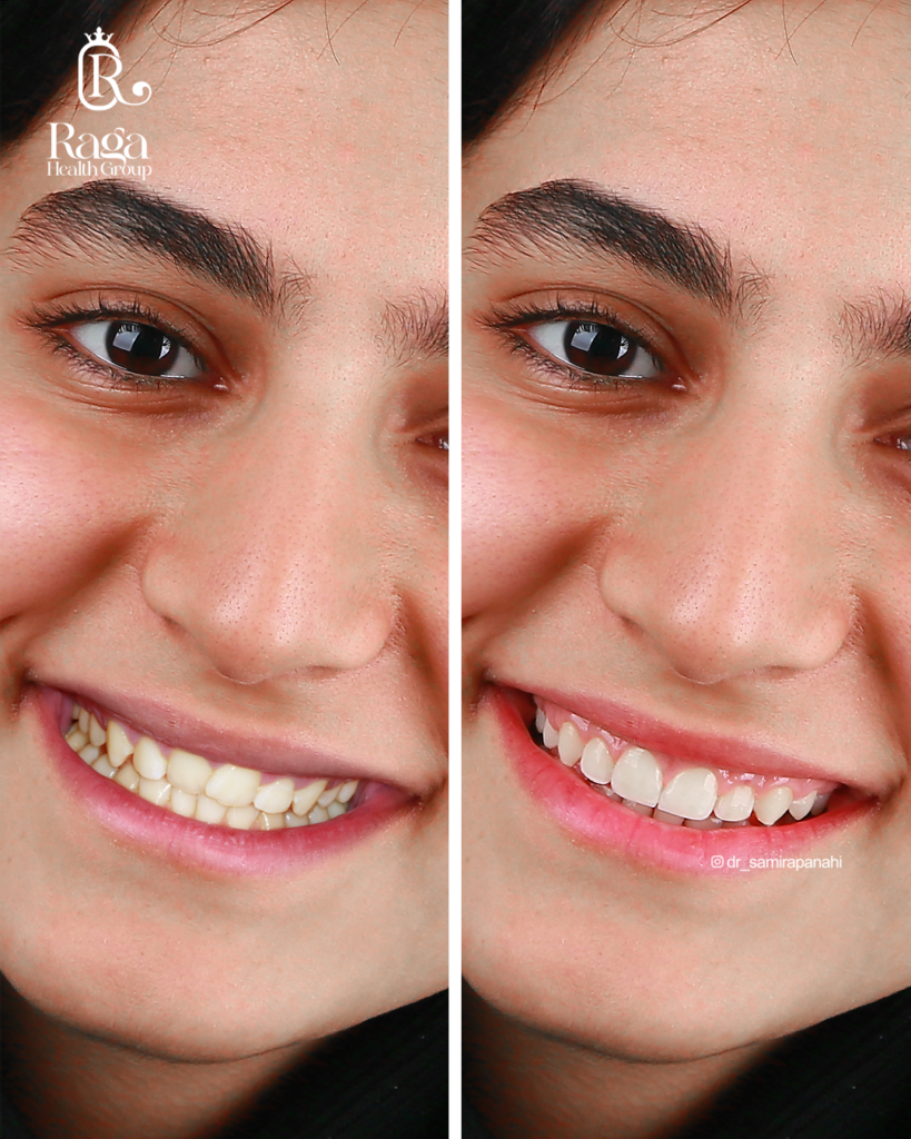 نمونه کار لبخند راگا 36