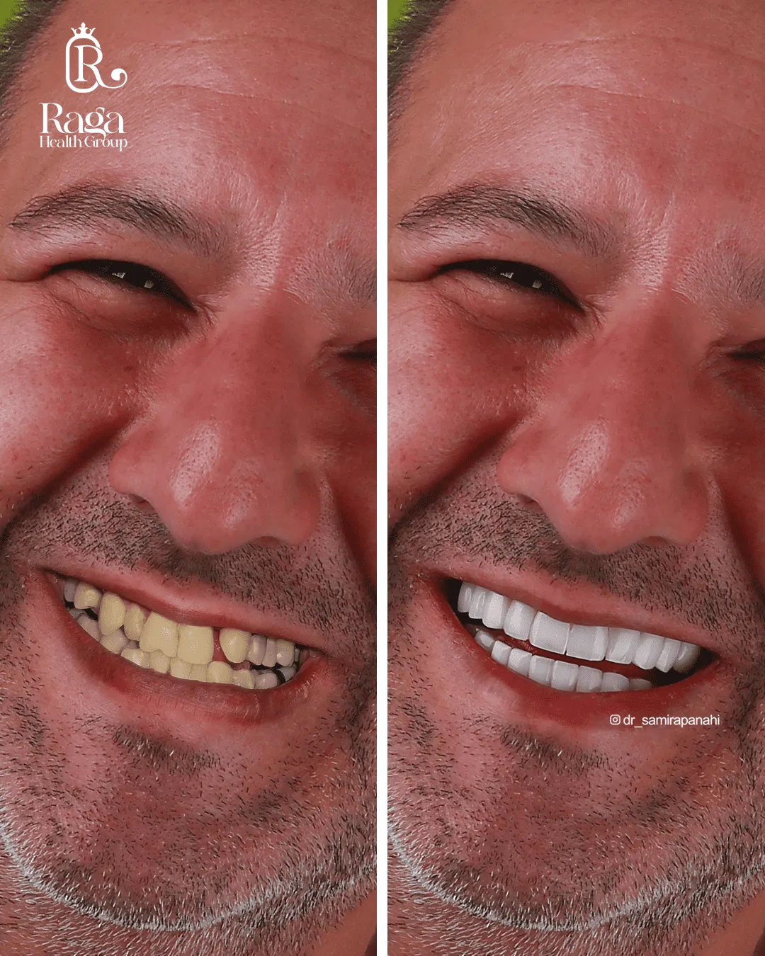 نمونه کار لبخند راگا 4