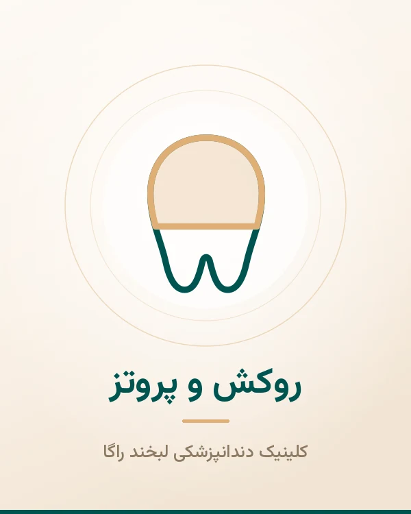 روکش و پروتز لبخند راگا