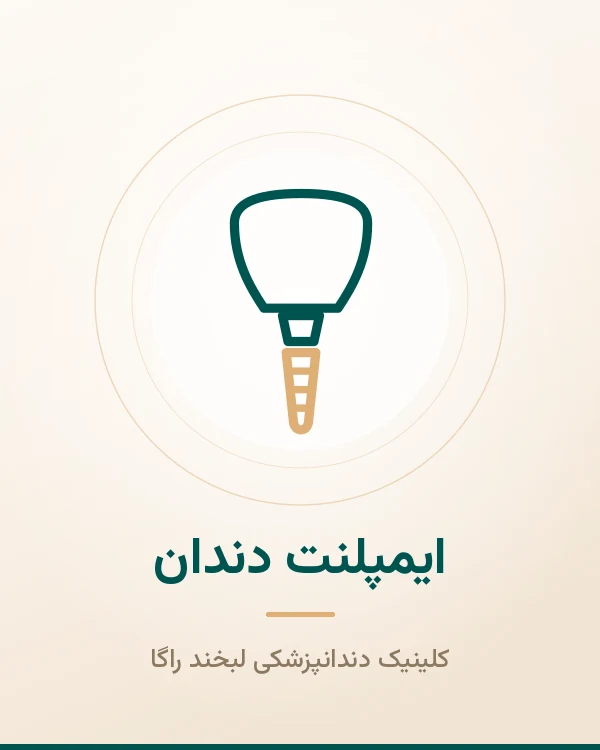 ایمپلنت دندان