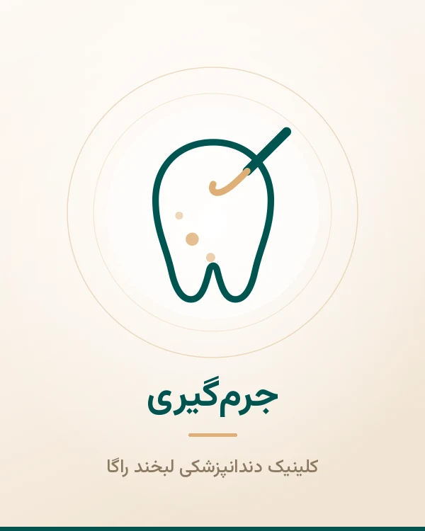 جرم گیری لبخند راگا
